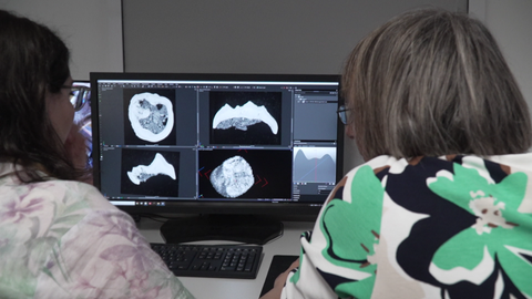 Die Forschenden untersuchten entdeckten Zähne und Knochen des kleinsten Menschenaffen am Computertomographen.