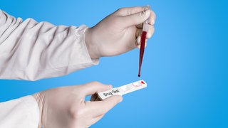 Drogentest, Blutuntersuchung. Symbolfoto.