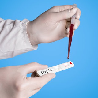 Drogentest, Blutuntersuchung. Symbolfoto.