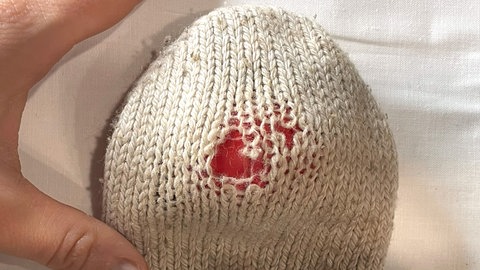 Loch stopfen mit Swiss Darning Technik