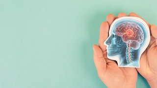 Kopf mit Hirntumor. Das DKFZ in Heidelberg und die Berliner Charité arbeiten an einem KI-Modell, das über 170 Tumorarten anhand ihres molekularen Fingerabdrucks erkennt – mit hoher Genauigkeit.