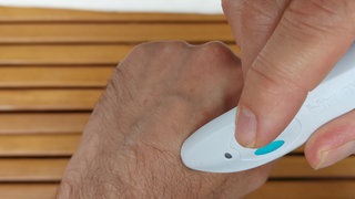 Wie genau die Hitzestifte nach Insektenstichen den Juckreiz linden sollen, ist noch nicht geklärt. Auch Kälte und Elektrostimulation sollen helfen.