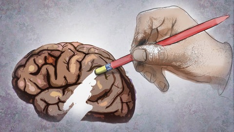 Die EU-Kommission hat ein neues Medikament gegen Alzheimer zugelassen: Lecanemab.