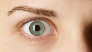 Weit geöffnetes Auge: Lidzucken kann verschiedene Gründe haben, und es ist nicht immer so leicht zu erkennen, woran es genau liegt. Normalerweise zuckt nur das rechte oder linke Auge, und dann auch nur das obere oder untere Augenlid.