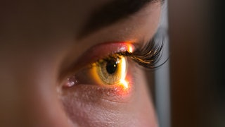 Untersuchung der Netzhaut beim Augenarzt