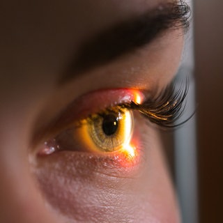 Untersuchung der Netzhaut beim Augenarzt