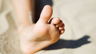 Großer Zeh - hallus valgus bekämpfen