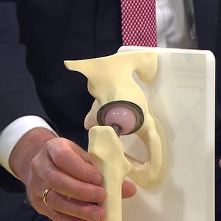 Modell eines künstlichen Hüftgelenks