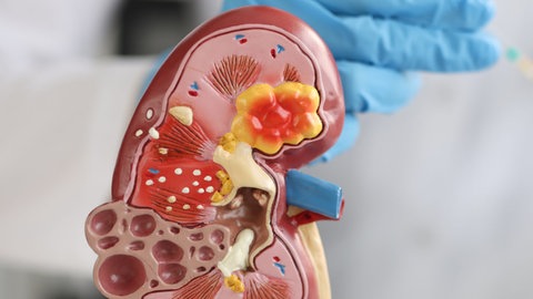 Man sieht das Modell einer Niere.