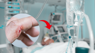 Rundes Bild mit Schnitt an Finger und roter Pfeil auf Hintergrund: Intensivstation