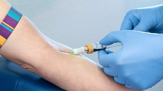 Venöse Blutentnahme in der Ellenbeuge. Oberarm ist mit einem Band abgeschnürt. Nadel steckt in der Haut. Blut sammelt sich im Röhrchen. 