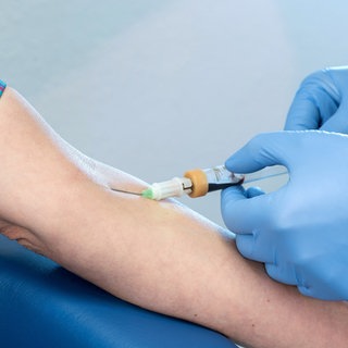 Venöse Blutentnahme in der Ellenbeuge. Oberarm ist mit einem Band abgeschnürt. Nadel steckt in der Haut. Blut sammelt sich im Röhrchen. 