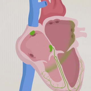 Grafik: Menschliches Herz