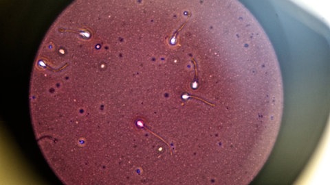Spermien unter dem Mikroskop. Die neue hormonfreie Pille für den Mann stoppt die Spermienproduktion.