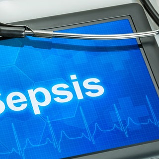 Darum ist eine Sepsis so gefährlich
