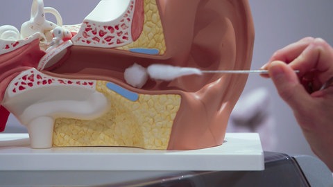 Darum können Wattestäbchen dem Ohr schaden