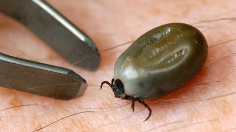 Ein vollgesaugte Zecke und eine Zeckenzange.