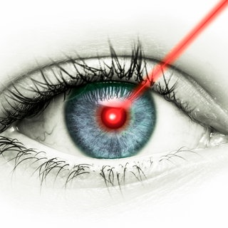 Auge mit Laser