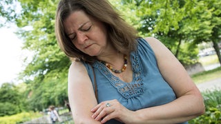 Eine Frau untersucht ihren Arm auf Stiche | Notfallsanitäter erklärt, was bei einem Wespenstich wichtig ist