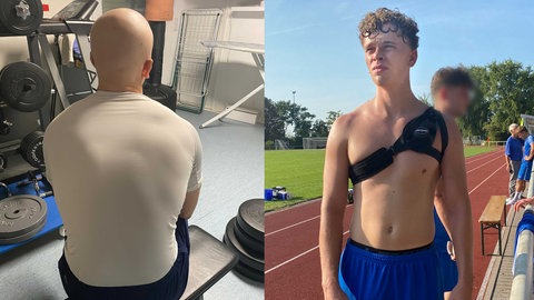 Bild-Kombination. Links ein durchtrainierter Mann mit Chemotherapie-Glatze. Er sitzt auf einer Hantelbank. Rechts der gleiche junge Mann auf dem Sportplatz. Um seinen freien Brustkorb ist eine Art Gurt geschlungen. SWR1 Neuanfang: Nachwuchsfußballer Max und sein Kampf gegen den Krebs. Bei dem jungen Mann aus Heidelberg wird ein Sarkon diagnostiziert, ein höchst aggressiver Krebs. Der Sport und seine Familie geben ihm die Kraft, die Chemotherapie und den Kampf gegen den Krebs erfolgreich zu bestehen.