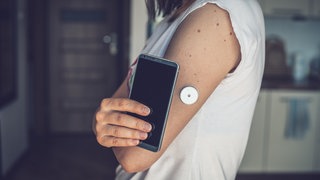 Blutzucker messen ohne stechen - auch ohne Diabetes: Eine Frau hat einen Sensor im Oberarm, um den Blutzckerspiegel (Gewebezucker) zu melden.