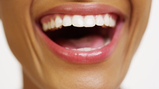 Frau lacht, Zähne, Kiefer