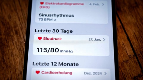Gesundheitsapp auf dem Handy mit EKG. KI kann über eine Smartwatch Herzkrankheiten erkennen.