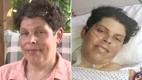 Eine Leberspende rettete Sandras Leben