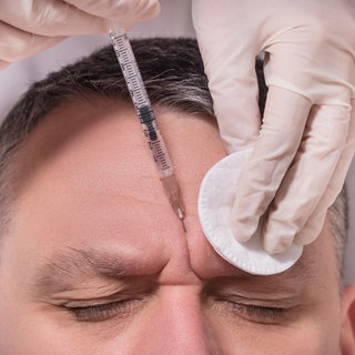 2024 gab es laut der Vereinigung Deutscher Ästhetisch-Plastischer Chirurgen 3.605 Botox-Behandlungen bei Männern.