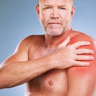 Mann mit Sonnenbrand - Hautpflege