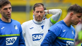 Oliver Baumann verletzte sich im Spiel gegen Borussia Dortmund am Kopf. 