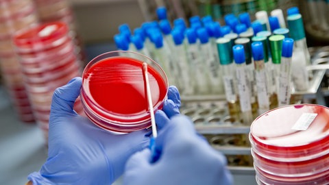 Eine Labormitarbeiterin verstreicht im Diagnostiklabor Untersuchungsmaterial mit einem Abstrichtupfer auf einer Bakterienkulturplatte. Antibiotikaresistenz: Was tun, wenn Antibiotika nicht mehr gegen Bakterien und Krankenhauskeime wirken? Prof. Peter Seeberger forscht an neuen Medikamenten, auch gegen Krebs und Malaria. Antibiotikaresistenz ist eine große Gefahr - in SWR1 Leute erzählt er von seiner Forschung an neuen Medikamenten und Impfstoffen.