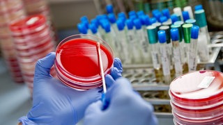 Eine Labormitarbeiterin verstreicht im Diagnostiklabor Untersuchungsmaterial mit einem Abstrichtupfer auf einer Bakterienkulturplatte. Antibiotikaresistenz: Was tun, wenn Antibiotika nicht mehr gegen Bakterien und Krankenhauskeime wirken? Prof. Peter Seeberger forscht an neuen Medikamenten, auch gegen Krebs und Malaria. Antibiotikaresistenz ist eine große Gefahr - in SWR1 Leute erzählt er von seiner Forschung an neuen Medikamenten und Impfstoffen.