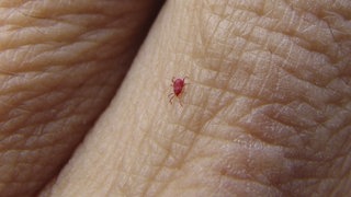 Eine rote Grasmilbe auf einem Finger.