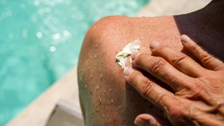 Eine weibliche Hand, die einer männlichen Person am Pool Sonnencreme auf die gerötete Schulter aufträgt.