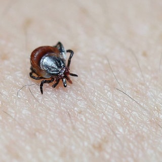 Eine Zecke krabbelt über die Haut - ein Biss könnte gesundheitliche Folgen haben.