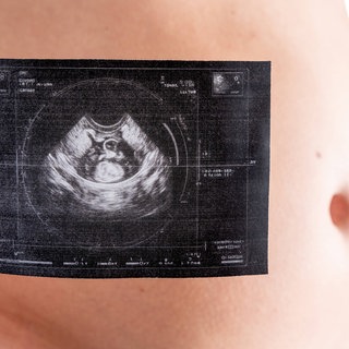 Eine schwangere Frau mit Ultraschallfoto