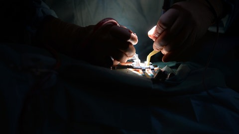 Ein Mediziner arbeitet in einer Klinik während einer Bandscheibenoperation an der Lendenwirbelsäule mit medizinischem Werkzeug.