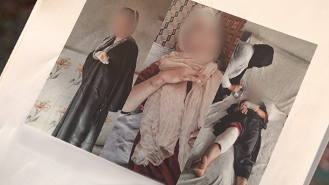 Ein Foto von Alis Schwestern zeigt ihre schweren Verletzungen.