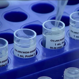 Impfstoff wird in Glässchen gefüllt