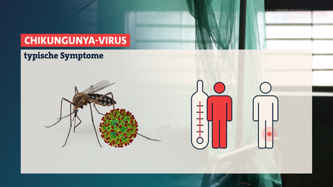 Illustration der Symptome bei Chikungunya: Typisch sind bei einer Infektion mit dem Chikungunya-Virus sind Fieber und Gelenkschmerzen.
