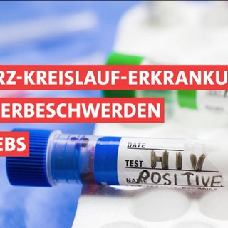 Erklär HIV-Forschung