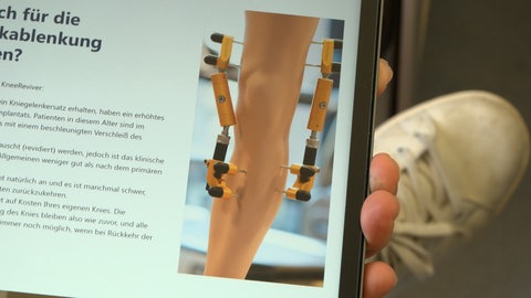 Ein Modell zeigt die Distraktion an einem Knie. Schrauben oberhalb und unterhalb des Knies ziehen das Gelenk auseinanderm anschließend wird es in dieser Position für mehrere Wochen fixiert.