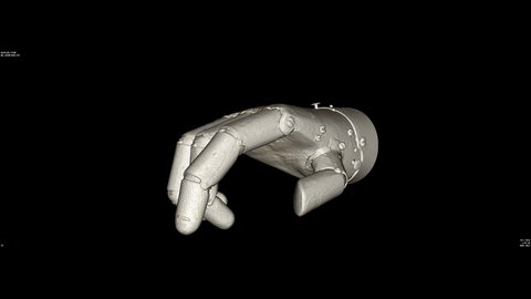 Eiserne Hand Götz von Berlichingen