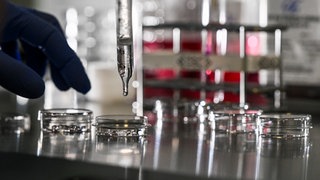 Symbolbild. Kulturschalen und Pipette in einem Labor. Das Land Baden-Württemberg fördert die PFAS-Forschung