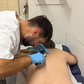 Ein Arzt mit blauen Hygienehandschuhen kontrolliert mit einer Lupe die Muttermale auf dem Körper eines Mannes.