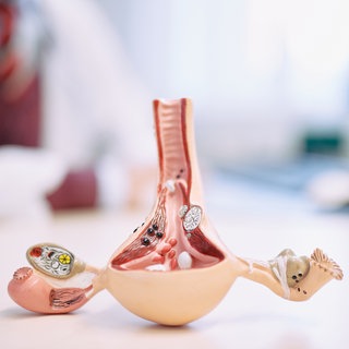 Ein Forschungsverbund der Uniklinik Tübingen erhält Millionen für die Forschung zu Endometriose. Rund zwei Millionen Frauen in Deutschland sind von der Erkrankung betroffen.