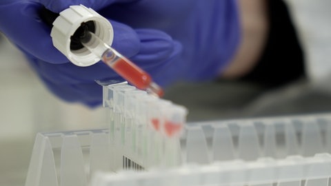 Pipette im Labor mit Blut gefüllt