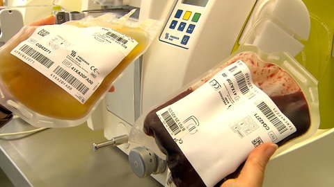Jemand hält zwei Beutel mit Blutspenden in der Hand: Links Blutplasma, rechts roten Blutkörperchen.