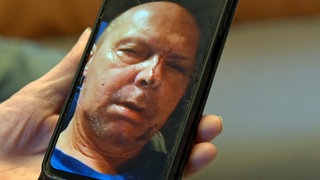 Nach einem Steinwurf vergangenes Jahr auf der A7 bei Ellwangen ist der Schwäbisch Gmünder LKW-Fahrer Wolfgang Hahn auf dem rechten Auge blind. 